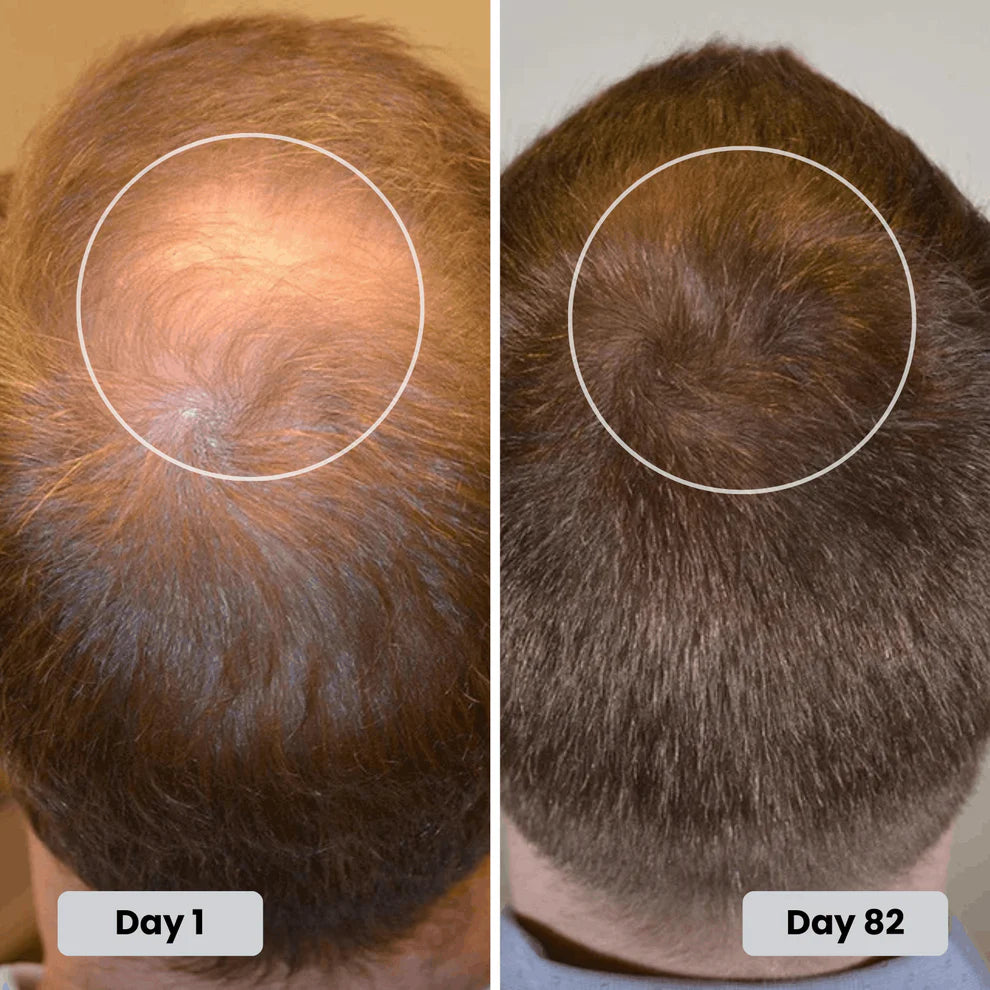 Before and After