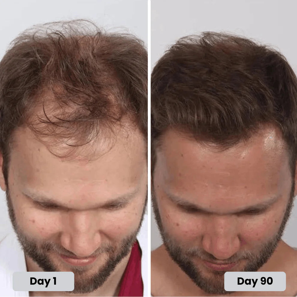 Before and After